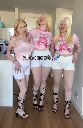 Full leaked Albino models private photo
