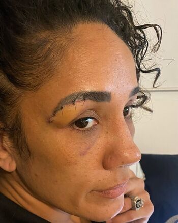 Full leaked Amanda serrano private photo