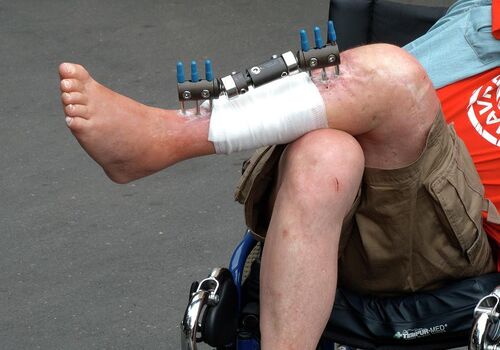 Full leaked Brokenleg private photo
