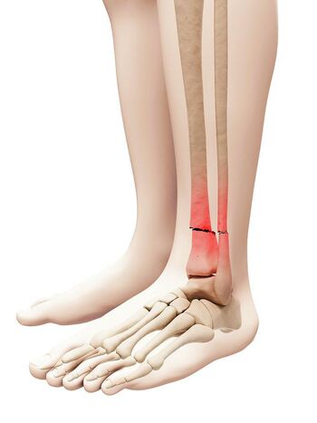 Full leaked Brokenleg private photo