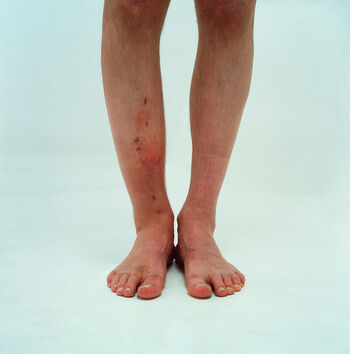 Full leaked Brokenleg private photo