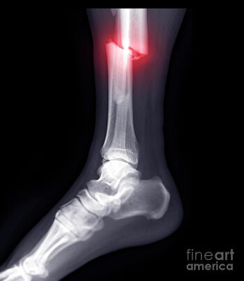 Full leaked Brokenleg private photo