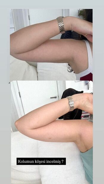 Full leaked Buse aydn private photo