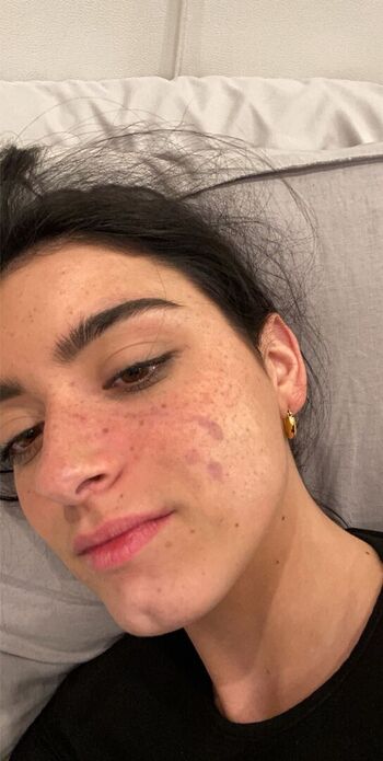 Full leaked Dixie d amelio page private photo