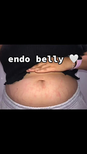 Full leaked Katherine h private photo