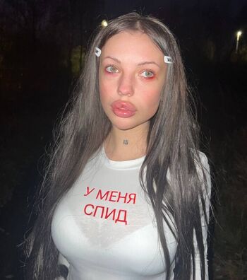 Severserves