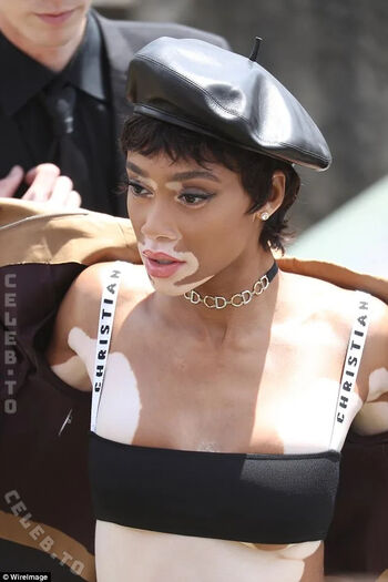 Full leaked Winnie harlow private photo