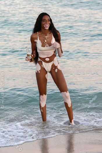 Full leaked Winnie harlow page private photo