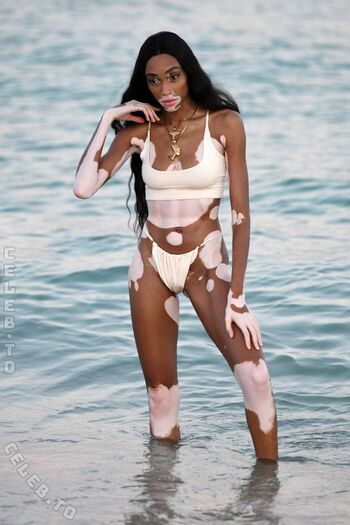 Full leaked Winnie harlow page private photo