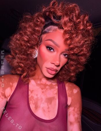 Full leaked Winnie harlow page private photo