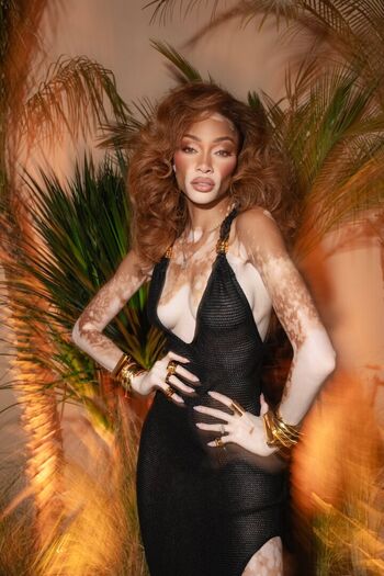 Winnie Harlow