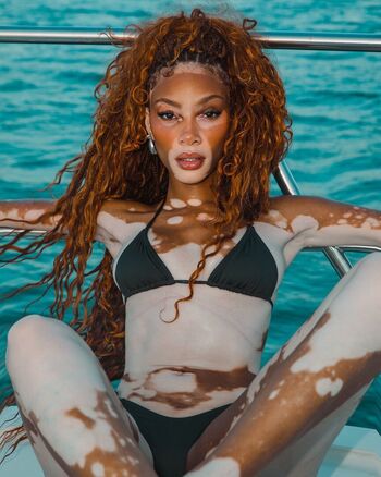 Full leaked Winnie harlow page private photo