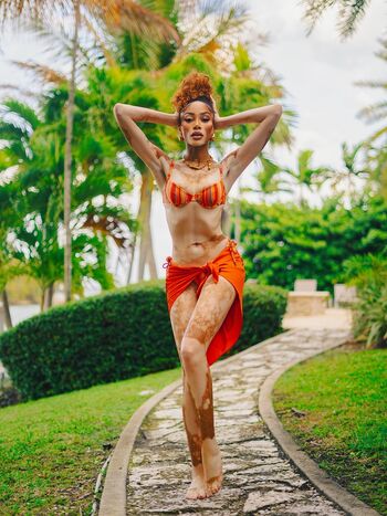 Winnie Harlow