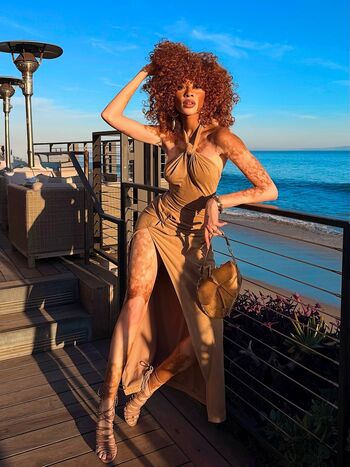 Full leaked Winnie harlow private photo