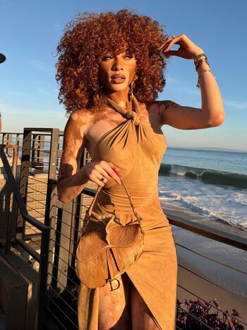 Winnie Harlow