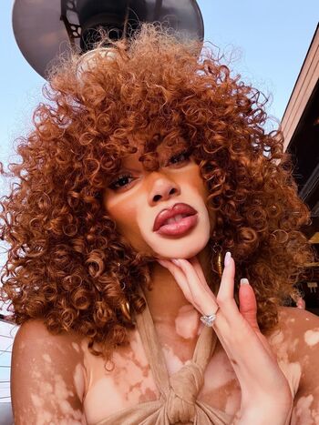 Winnie Harlow