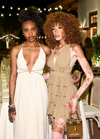 Winnie Harlow