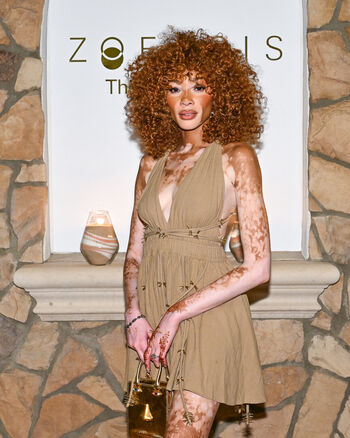 Full leaked Winnie harlow private photo