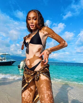 Full leaked Winnieharlow private photo