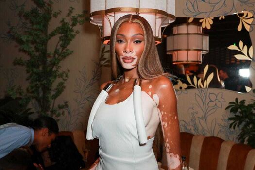 Full leaked Winnieharlow private photo