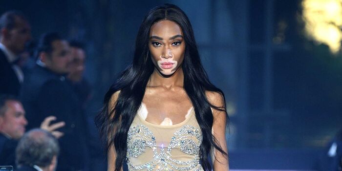 Full leaked Winnieharlow private photo