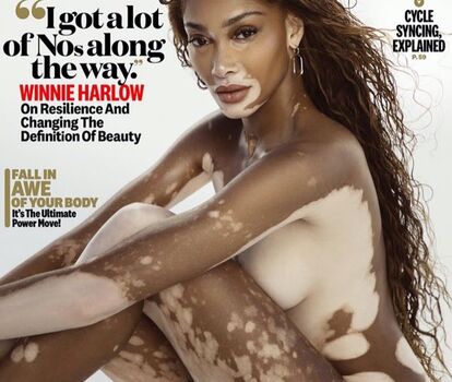 Full leaked Winnieharlow private photo
